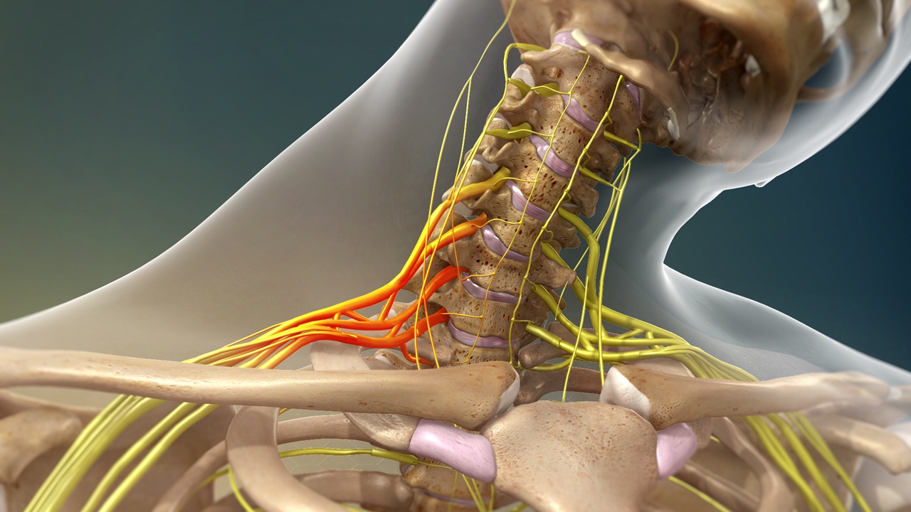 Glioma Surgery